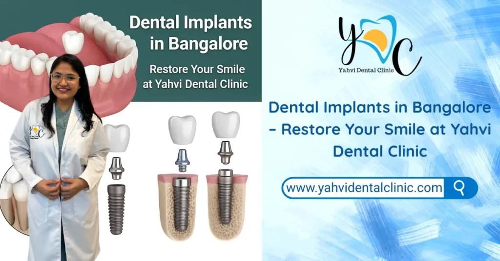 dental implants in bangalore yahvi dental clinic