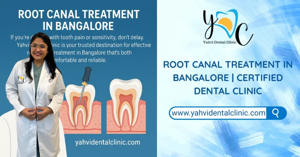 root canal treatment in bangalore