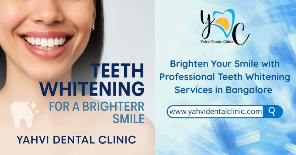 teeth whitening treatment teeth whitening services
